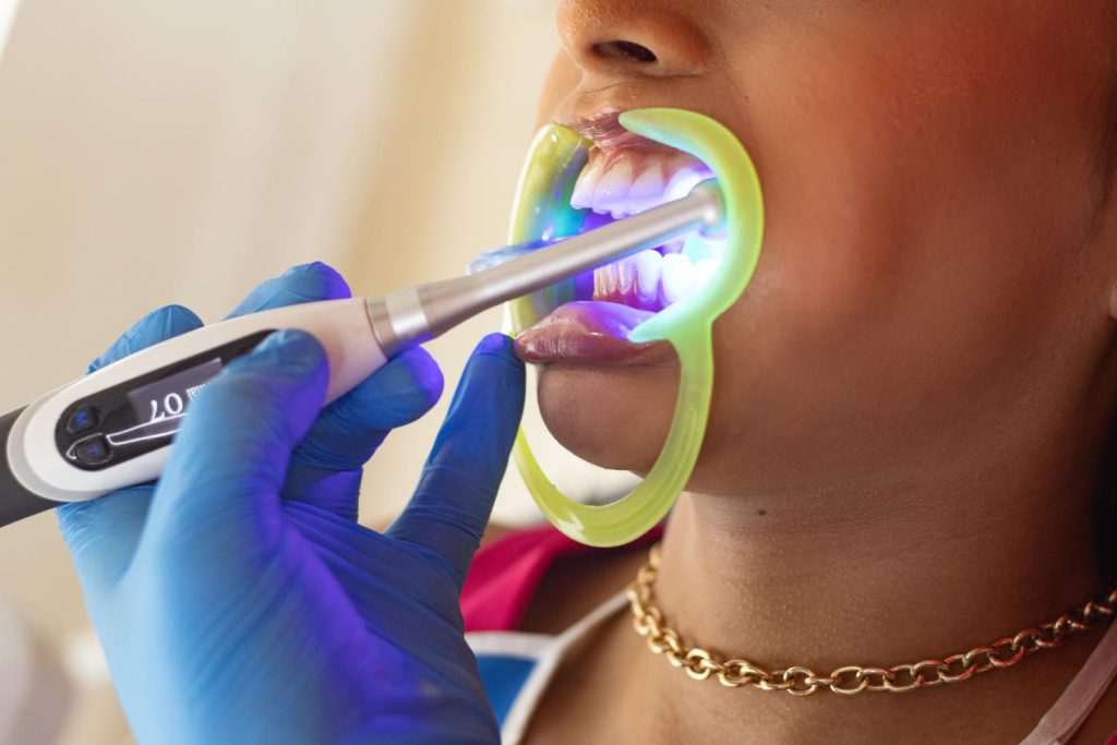 Jeśli masz wrażliwe zęby, warto skonsultować się ze swoim dentystą przed rozpoczęciem jakiejkolwiek metody wybielania